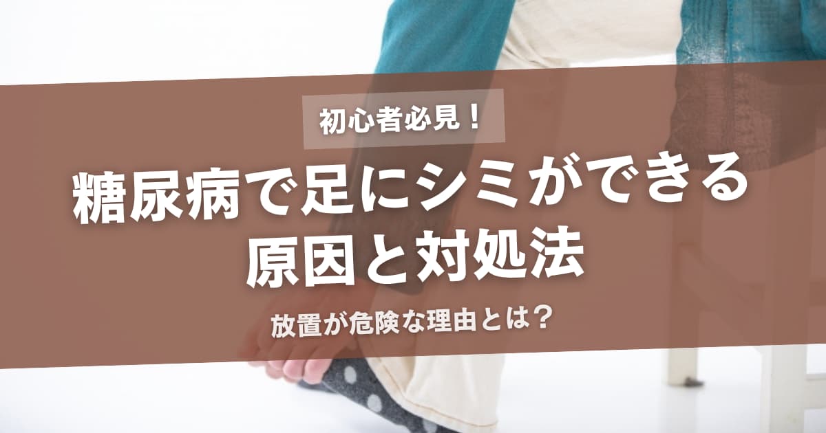 糖尿病で足にシミができる原因と対処法